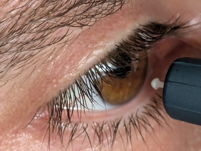 Augeninnendruckmessung vor Ort – SehVia mobiler Optiker Leipzig